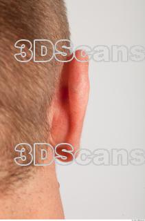 Ear texture of Gene 0003